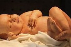 沈阳202医院做三代试管婴儿怀孕需要多少费用？