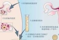 广州试管婴儿三代大概要多少钱？44岁可以做试管婴儿吗？